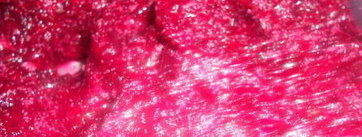 свекольные котлеты. Шаг 4