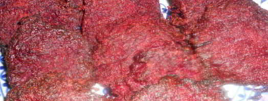 свекольные котлеты. Шаг 6