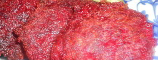 свекольные котлеты. Шаг 7