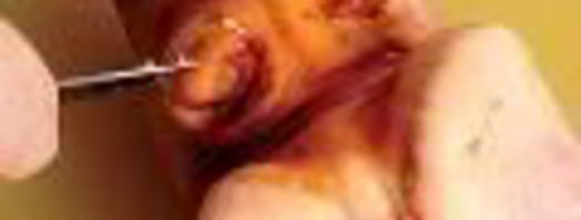 холодец гояжьей рульки и копыта. Шаг 4